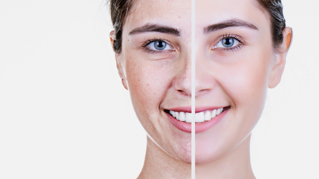 Eternal Youth: The Amazing Anti-Aging Potential of L-Theanine
