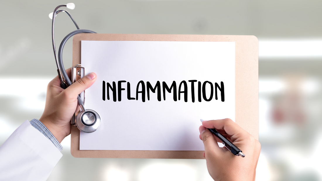 L-Theanine: A Potential Anti-Inflammatory Solution