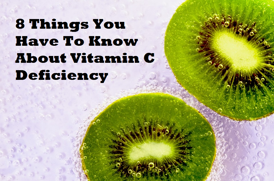 8 Things You Have To Know About Vitamin C Deficiency